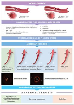 Contemporary review on spontaneous coronary artery dissection: insights into the angiographic finding and differential diagnosis